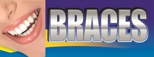Braces Vinyl Banner Sign